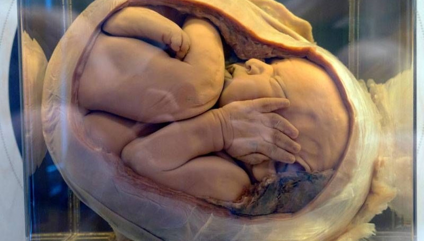 Kriyoteknoloji tüp bebek alanında bir çığır açtı Kriyoteknoloji tüp bebek alanında bir çığır açtı