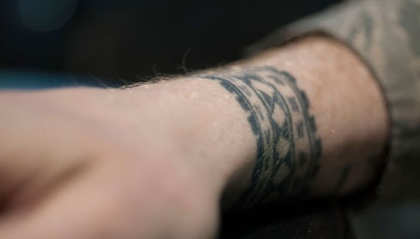 Yanlış dövme silme uygulamaları kalıcı hasarlara neden oluyor