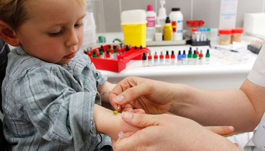 Bebek ve çocuklara alerji testi nasıl yapılır