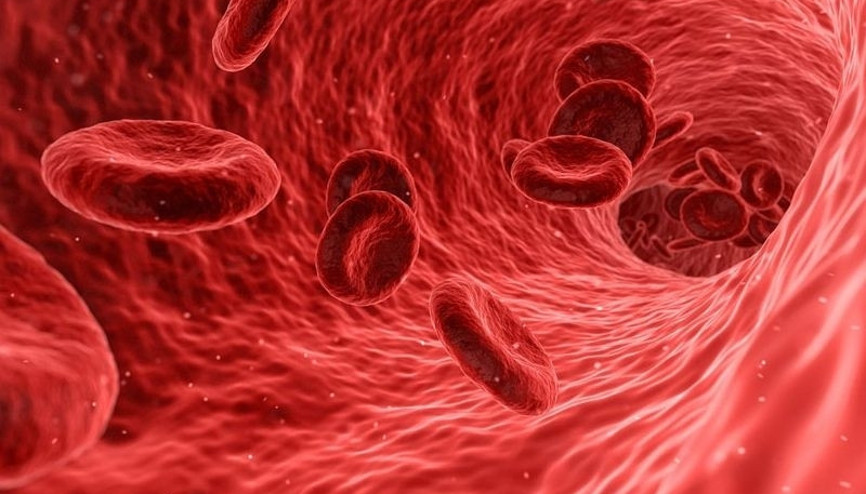 Talasemi nedir, belirtileri nelerdir