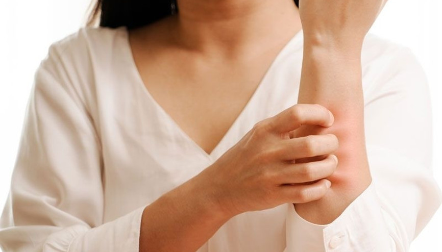 Ürtiker neden olur Belirtileri, çeşitleri, tedavisi