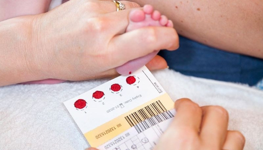 Bebeklerde topuk kanı testi hakkında bilinmesi gerekenler