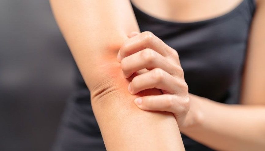 Kaşıntınız varsa böbrekleriniz sinyal veriyor