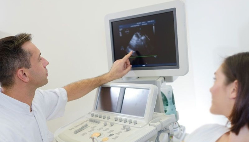 ’Çikolata kisti’ hamile kalmaya engel olabilir ’Çikolata kisti’ hamile kalmaya engel olabilir