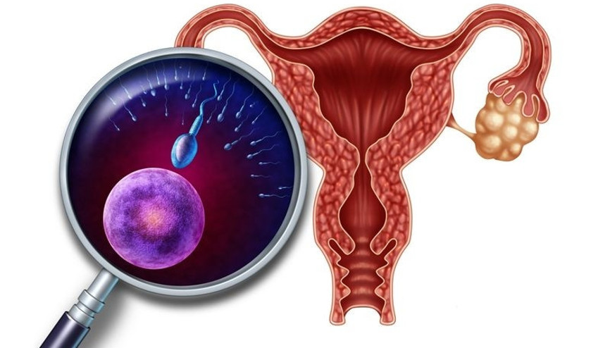 Yumurtalıklarınızı kendiniz tedavi etmeyin