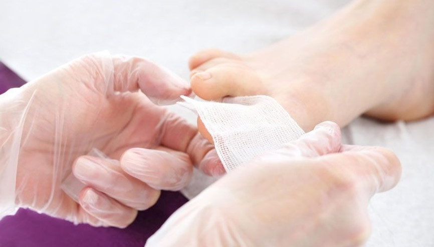 Tırnak batması neden olur Evde nasıl tedavi edilir