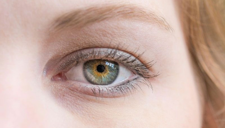 İri gözler tiroit hastalığı habercisi olabiliyor