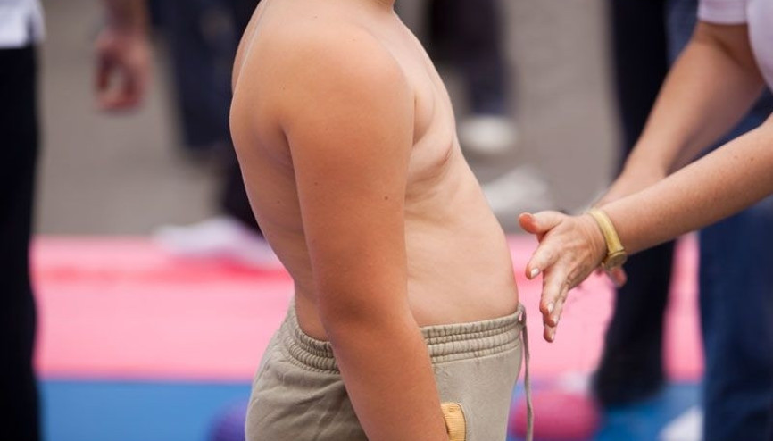 Yaz tatili çocuklarda obezite kontrolü için fırsat olabilir