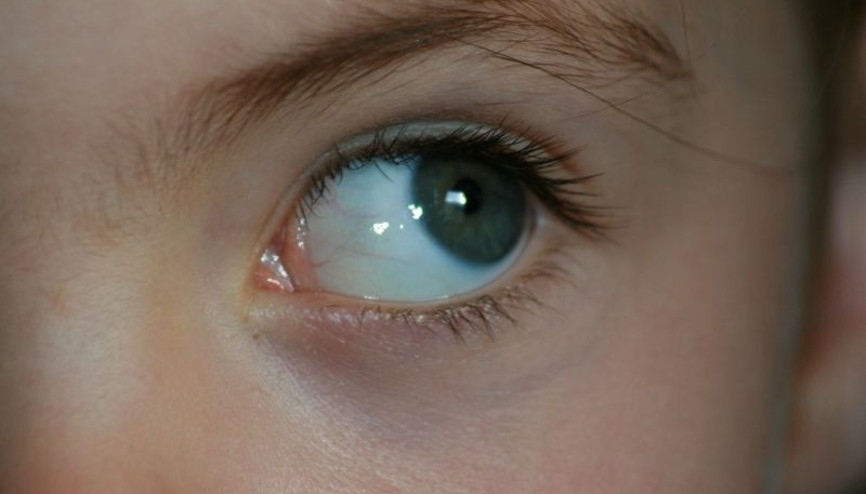 Çocuklarla EMDR: Geçmiş ile barışmanın en kolay yolu