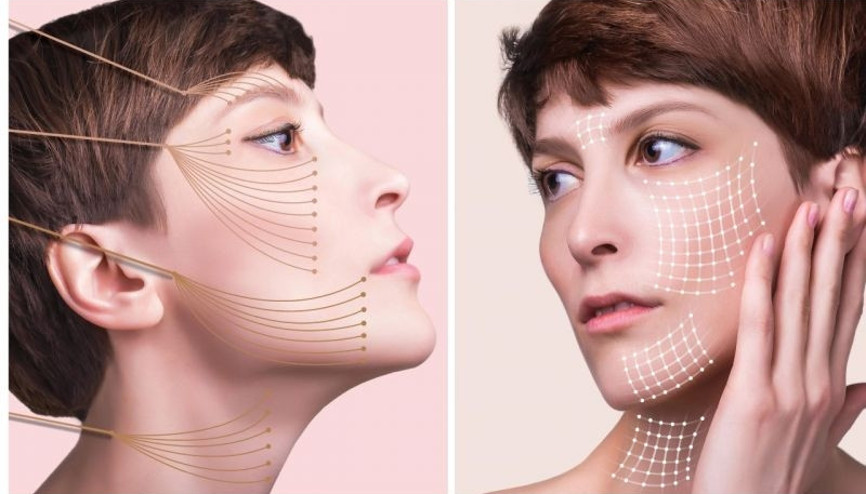 Fransız askısı ile ameliyatsız gençleşebilirsiniz