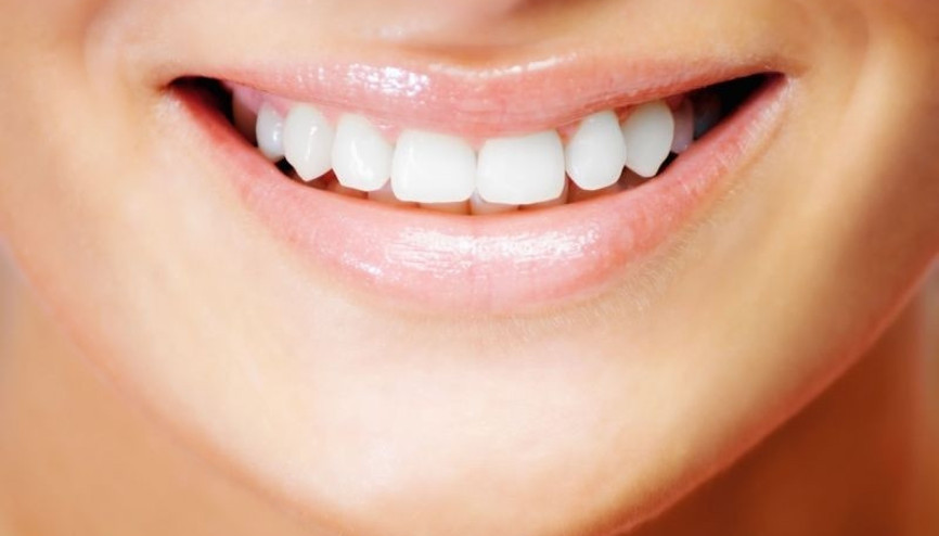 Gülüş estetiğiyle gülümsemenizi güzelleştirin