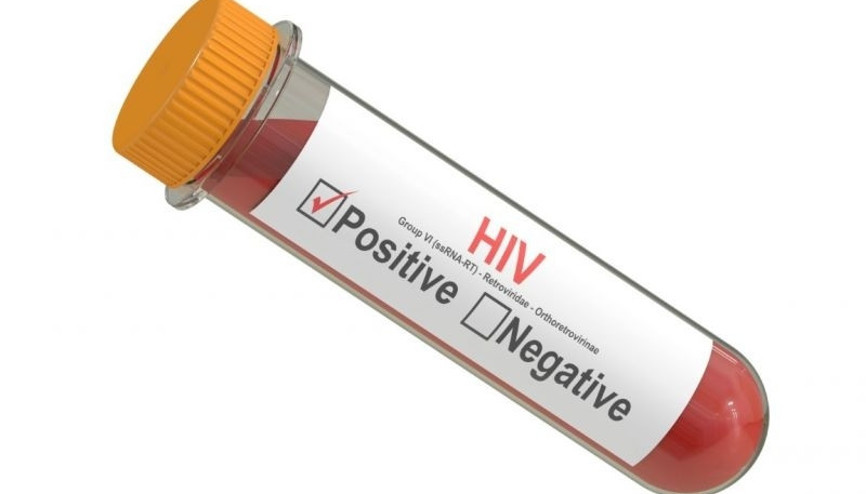 Aids hakkında merak ettiğiniz tüm soruların yanıtları