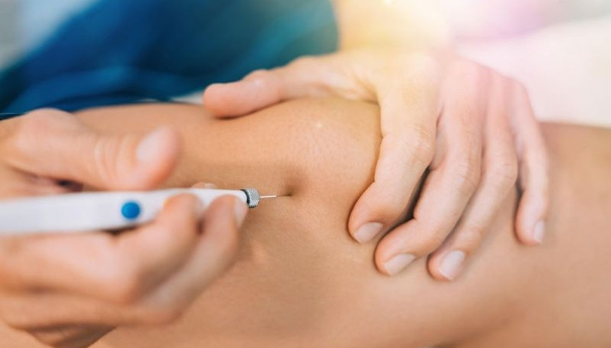 Kas ağrılarına ameliyatsız çözüm: Proloterapi tedavisi Kas ağrılarına ameliyatsız çözüm: Proloterapi tedavisi