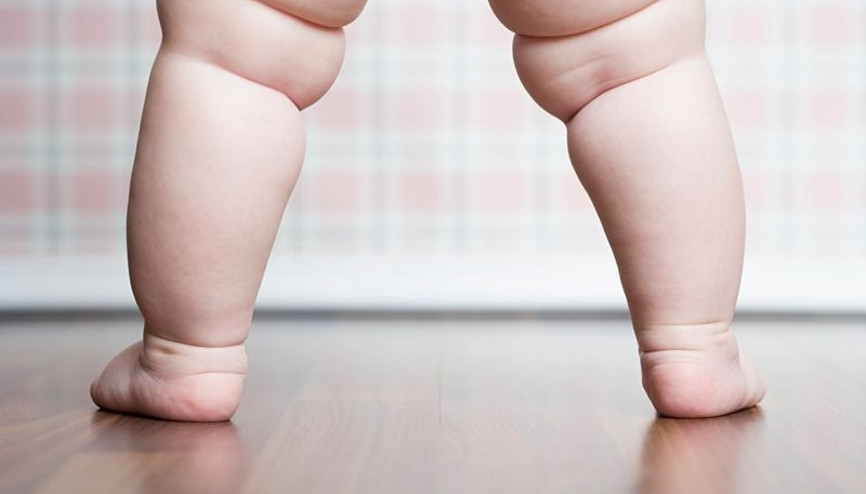 Raşitizm nedir Raşitizm nedenleri, belirtileri, tedavisi