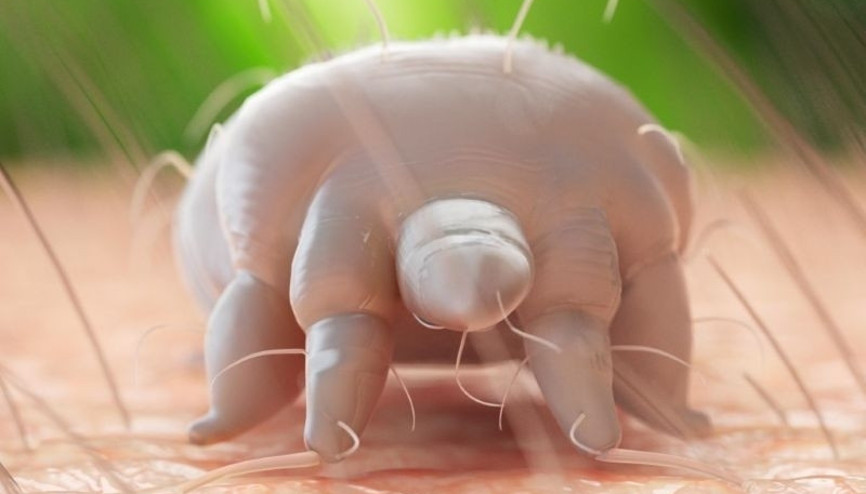 Uyuz hastalığı neden sık görülmeye başladı, tedavisi var mıdır