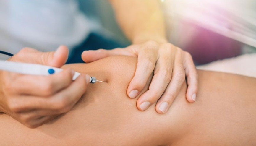 Proloterapi tedavisi nedir Proloterapi tedavisi nedir