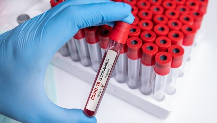 Corona virüs ile ilgili merak edilenler