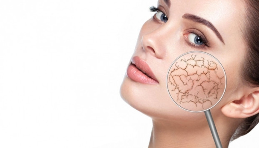 Kışın cilt kuruluğuna karşı 12 önemli kural