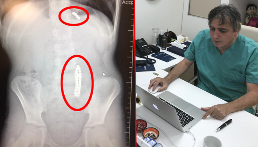 Karın ağrısı şikayetiyle hastaneye gitti... Doktorlar bile şaşkına döndü