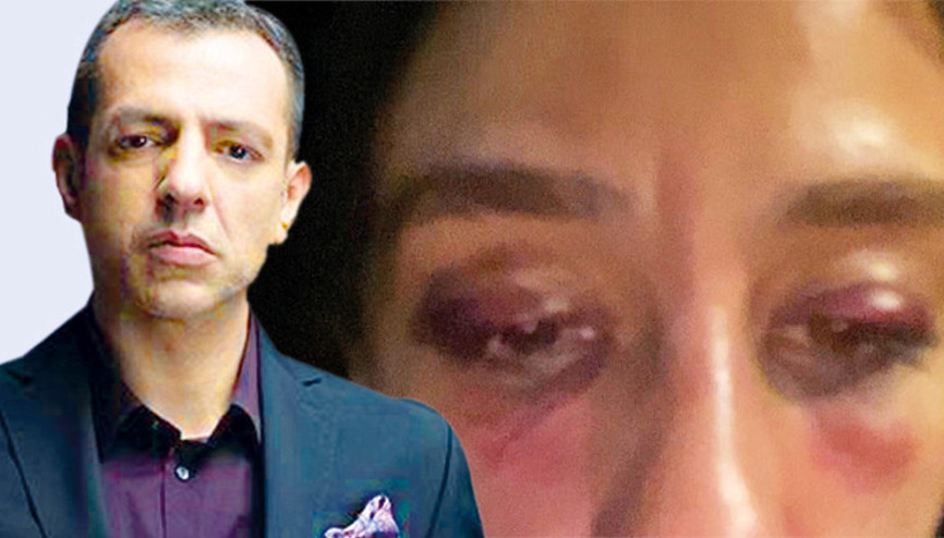 Rubato grubunun solisti Özer Arkun: Burcu’dan özür dilerim