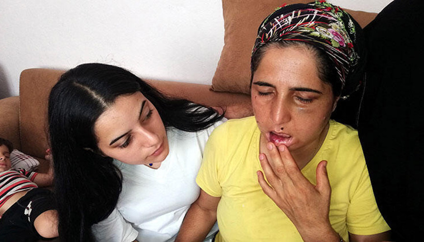 22 yıldır şiddet gören kadın konuştu