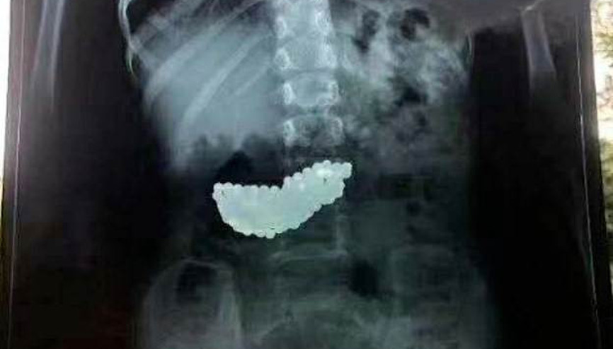 Küçük çocuk 2 ay boyunca böyle yaşadı Çinde inanılmaz olay