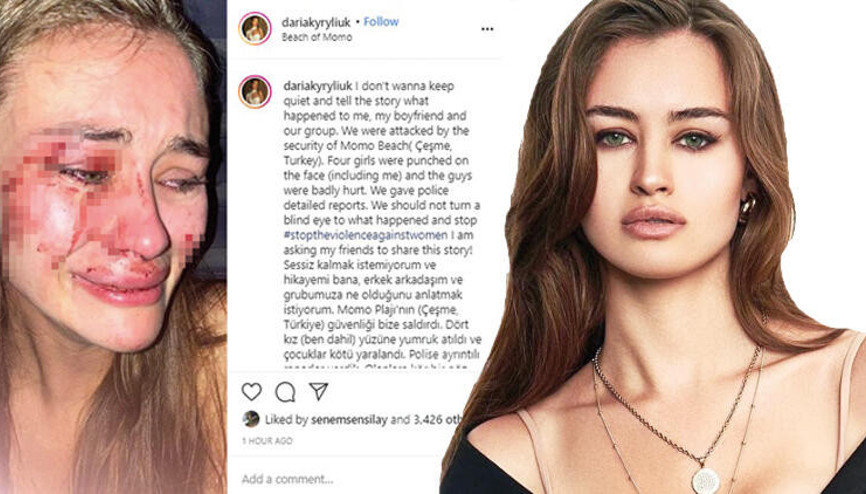 Top model Daria Kyryliuke plajda dayak O mekandan açıklama geldi