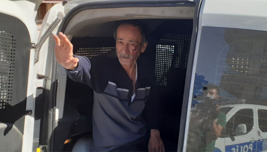 Ankara’da dehşet Eşinin parmağını ısırarak koparttı