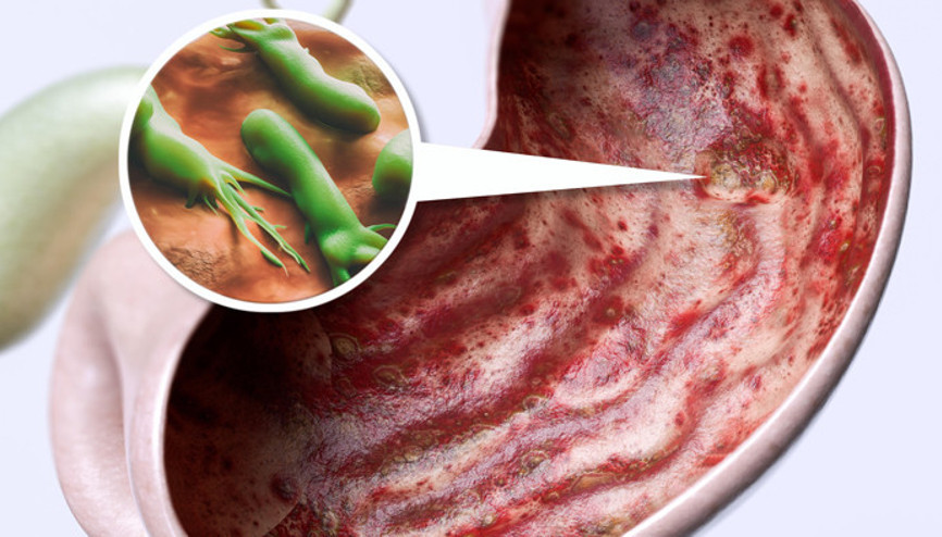Vücudumuzdaki gizli tehlike… Senelerce belirti vermeden yaşıyor