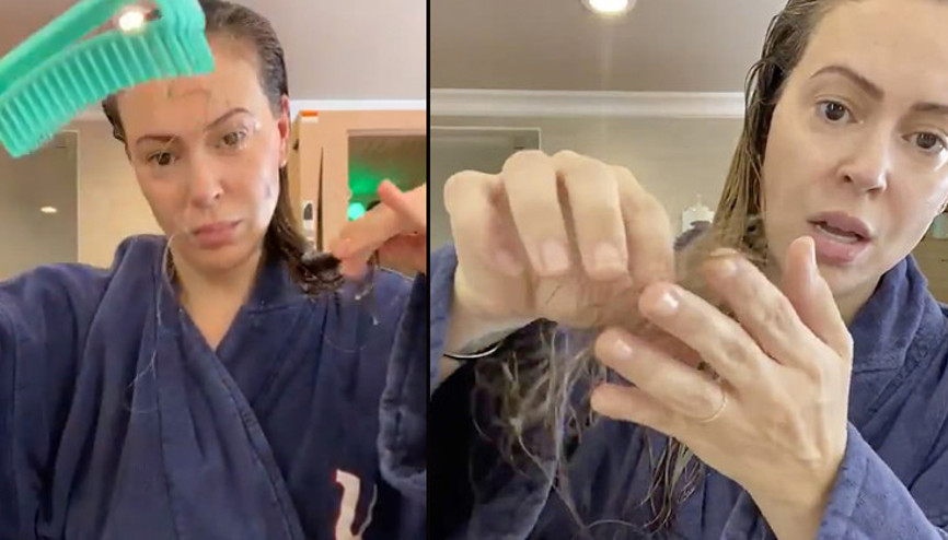 Ünlü oyuncudan şoke eden video: Koronavirüs yüzünden saçlarım avuç avuç dökülüyor