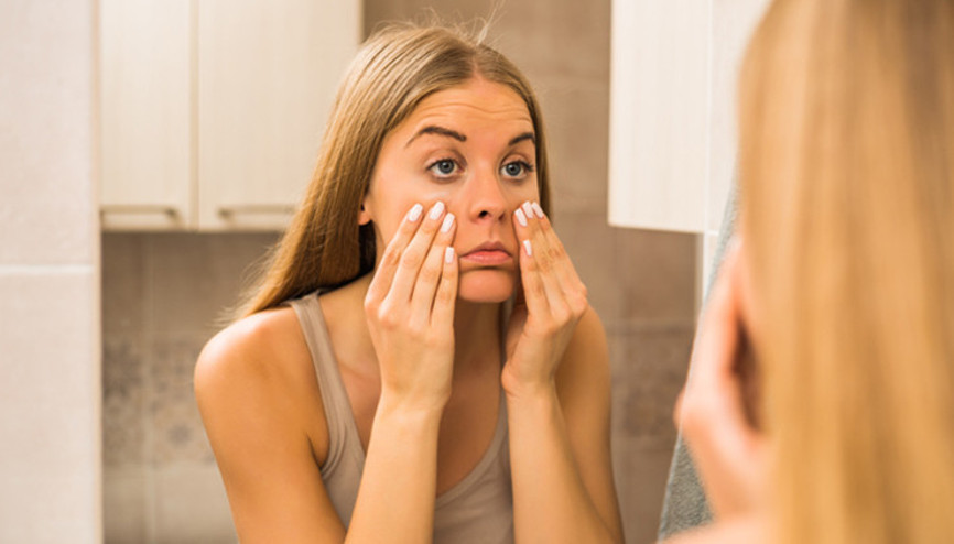 Göz altı morluklarının sebebi nedir ve nasıl geçer