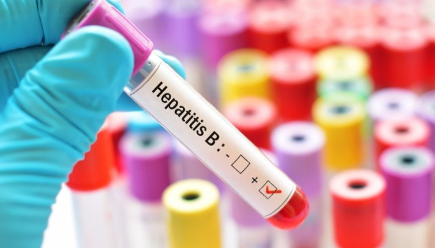 Hepatit B Nedir Belirtileri, Teşhisi ve Tedavisi Nasıldır