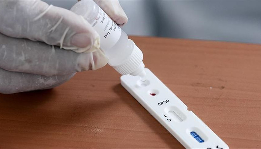 Trump yönetimi 150 milyon hızlı Kovid-19 testi satın alacak