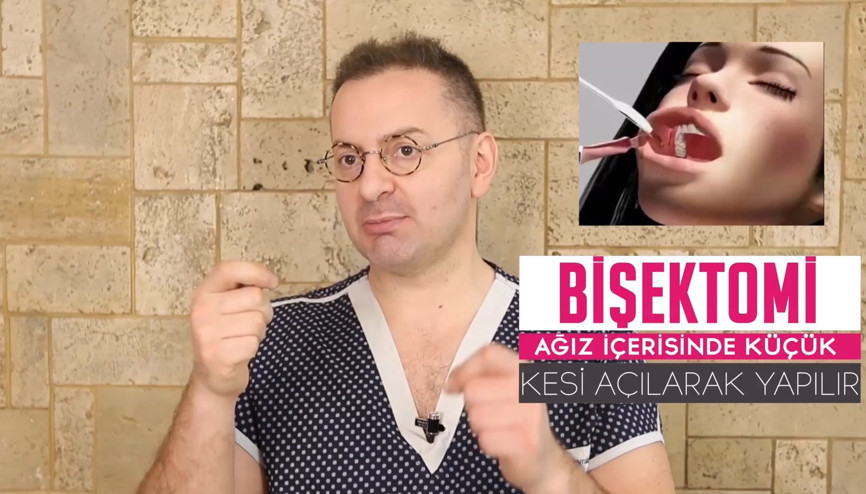 Bişektomi ile Yanak estetiği