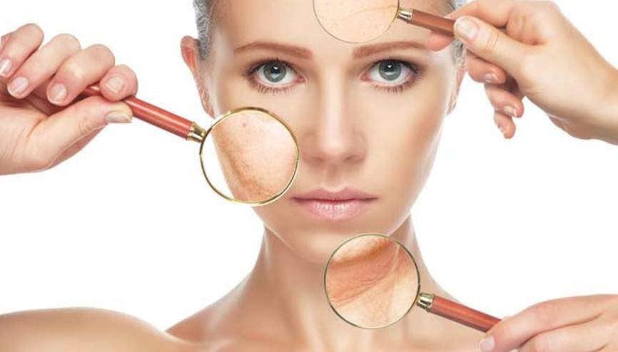 Yaz Aylarında Güneş Lekelerine Karşı Alınabilecek Önlemler