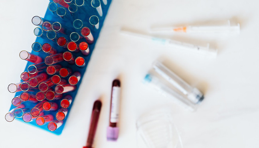 Meme Kanserinde Genetik Test Neden Önemli