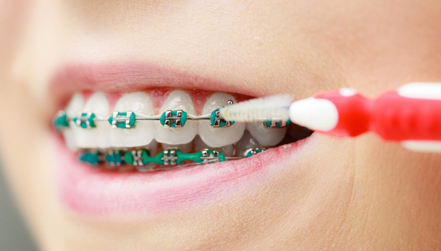 Ortodontik tedavi için diş hekimime gidebilir miyim