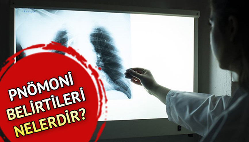 Pnömoni ile ilgili merak edilenler: Pnömoni ne demek Pnömoni belirtileri nelerdir