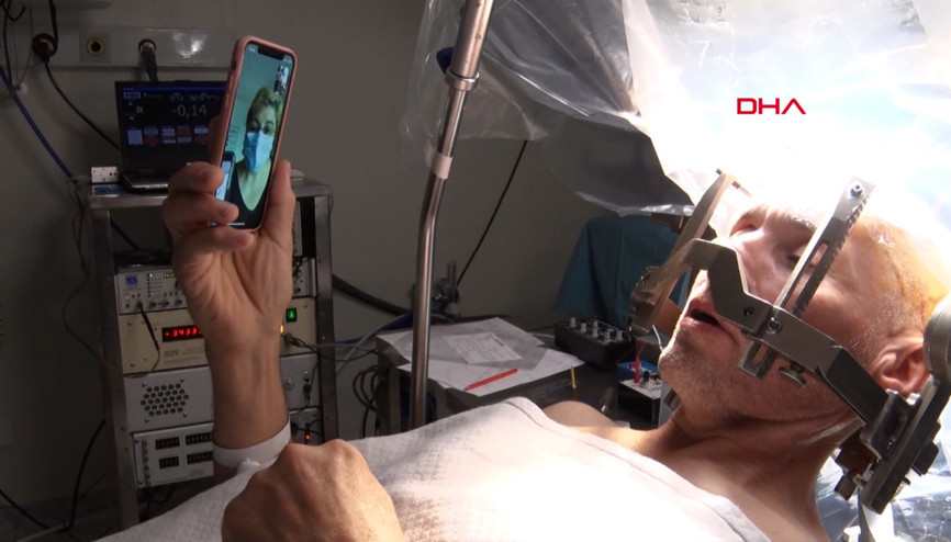 Beyin pili ameliyatında hem şarkı söyledi hem eşiyle görüntülü konuştu