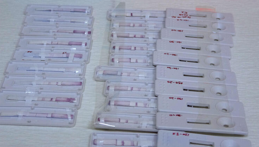 ÇOMÜde 8 dakikada sonuç veren çift antikorlu Covid-19 tanı kiti geliştirildi