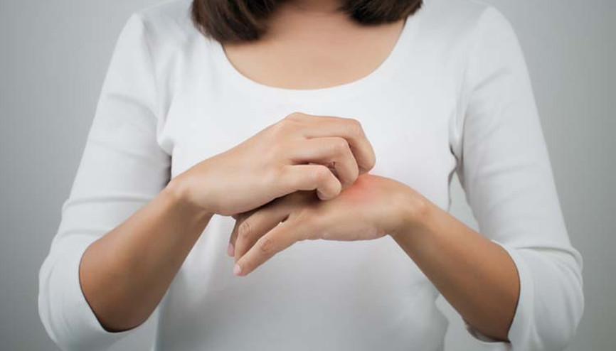 Egzama, alerjik hastalıkların habercisi olabilir