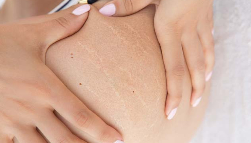 Vücutta Sarkma ve Çatlak Neden Oluyor Vücutta Sarkma ve Çatlak Neden Oluyor