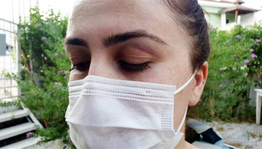 Hemşire, maske takmalarını istediği turistlerin terlikli saldırısına uğradı