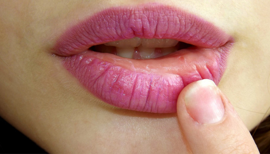 Dudaklarınızda, tırnak ve parmak uçlarınızda morarma varsa…