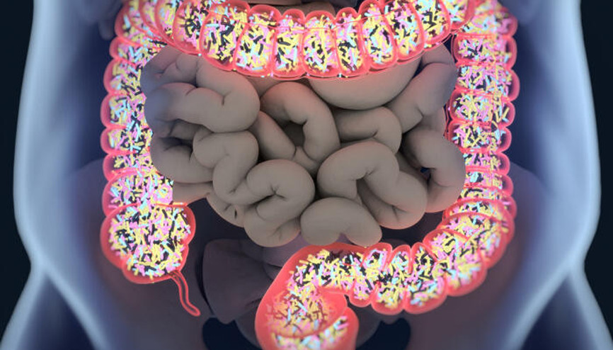 Kolon kanseri nedir, belirtileri nelerdir Kolon kanserinden nasıl korunulabilir