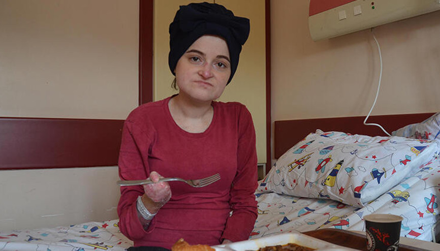 Doğuştan kelebek hastası olan Semra, 27 yıl sonra ilk kez et yiyebildi