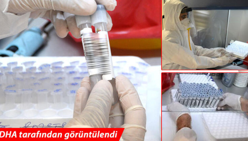 Bu laboratuvarda koronavirüs testi sonuçlarının kesinlik oranı yüzde 100