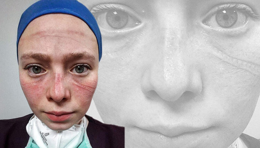 Yoğun bakım çalışma zorluğu yüzüne yansıyan Seher hemşireye övgü