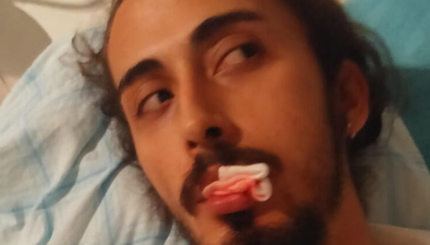 Sahilde gitar çaldığı sırada darbederek, çenesini kırdı