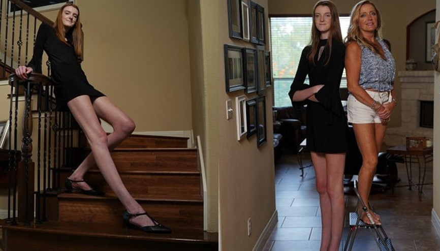 ABD’li genç kız dünyanın en uzun bacaklarına sahip kişi olarak Guinnesse adını yazdıracak